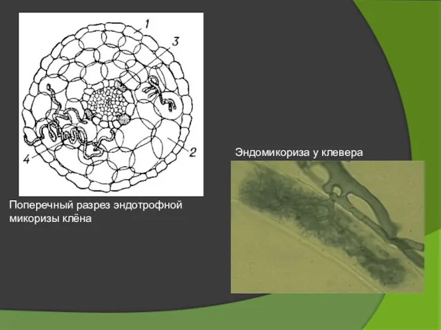 Поперечный разрез эндотрофной микоризы клёна Эндомикориза у клевера