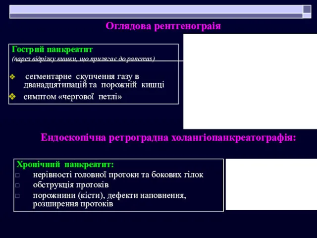 Хронічний панкреатит: нерівності головної протоки та бокових гілок обструкція протоків