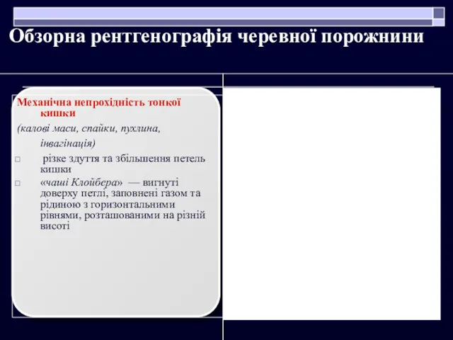 Обзорна рентгенографія черевної порожнини Механічна непрохідність тонкої кишки (калові маси,