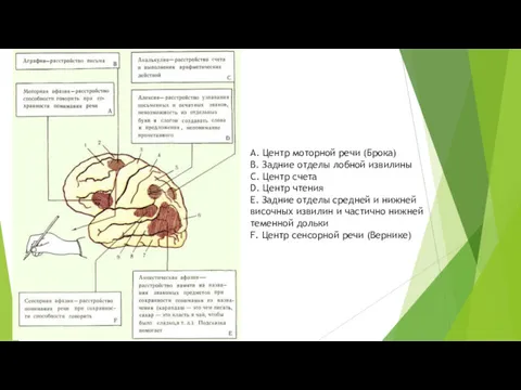 А. Центр моторной речи (Брока) В. Задние отделы лобной извилины C. Центр счета