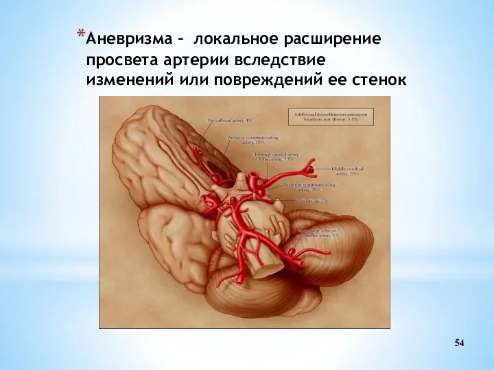 Аневризма – локальное расширение просвета артерии вследствие изменений или повреждений ее стенок