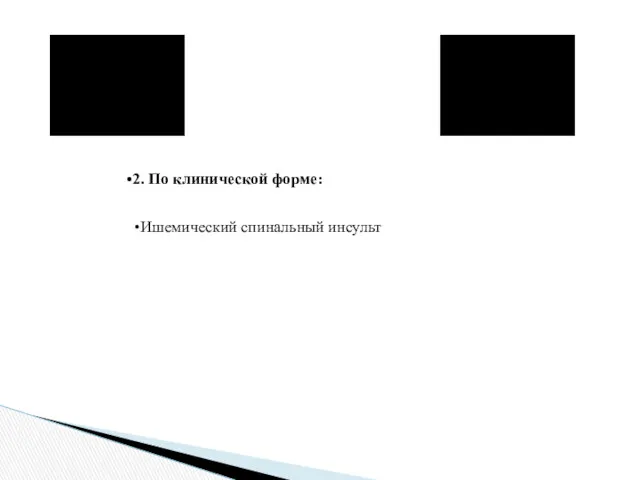 2. По клинической форме: Преходящие нарушения спинального кровообращения Ишемический спинальный инсульт Геморрагический спинальный инсульт