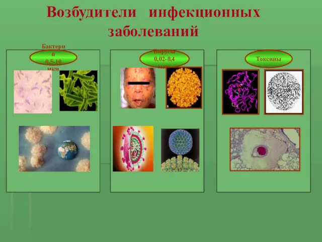 Бактерии 0,5-10 мкм Вирусы 0,02-0,4 мкм Токсины Возбудители инфекционных заболеваний