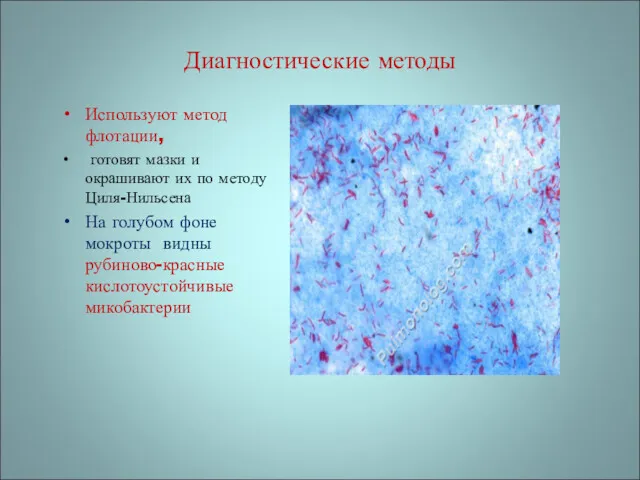 Диагностические методы Используют метод флотации, готовят мазки и окрашивают их