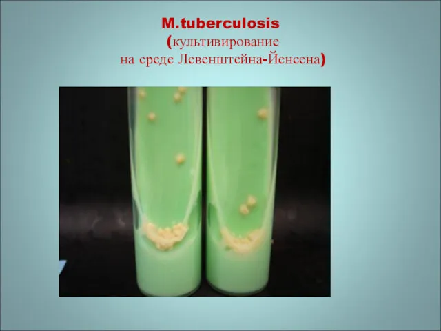 M.tuberculosis (культивирование на среде Левенштейна-Йенсена)