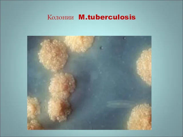 Колонии M.tuberculosis