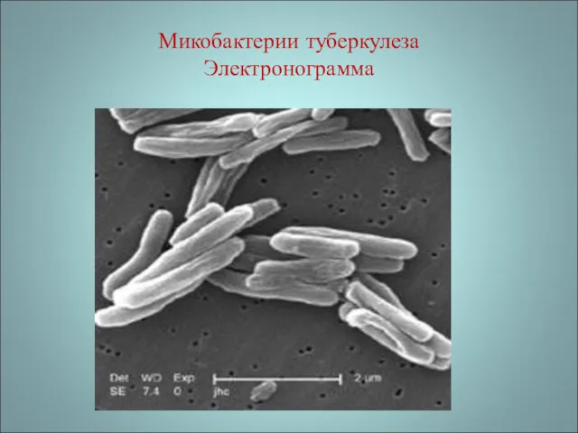 Микобактерии туберкулеза Электронограмма