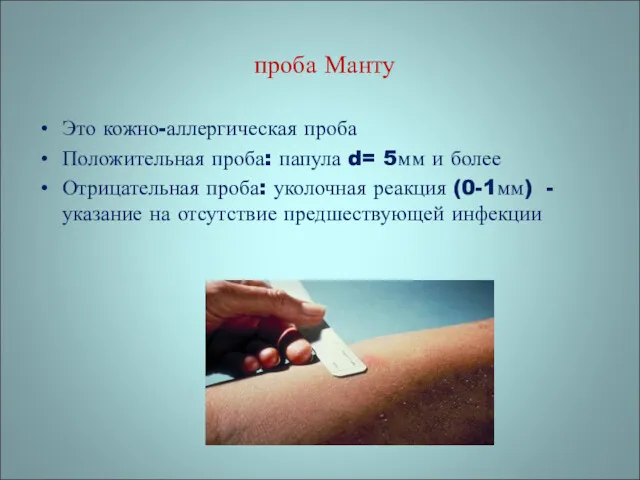 проба Манту Это кожно-аллергическая проба Положительная проба: папула d= 5мм