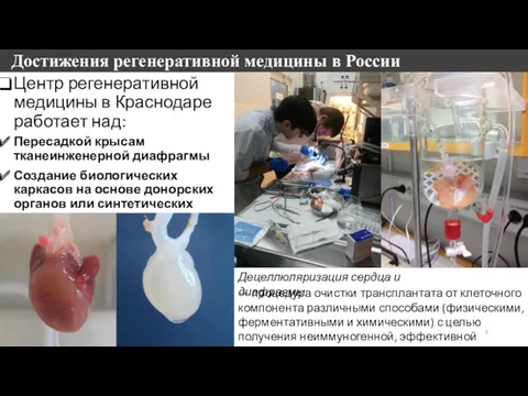 Достижения регенеративной медицины в России Центр регенеративной медицины в Краснодаре работает над: Пересадкой