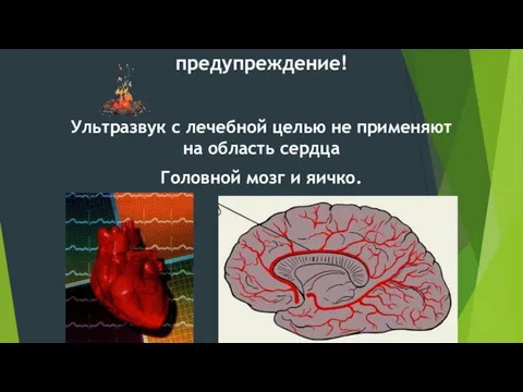 предупреждение! Ультразвук с лечебной целью не применяют на область сердца Головной мозг и яичко.