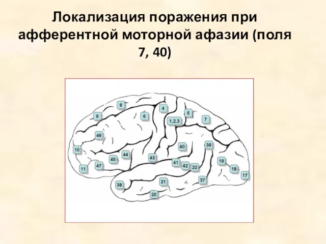 Локализация поражения при афферентной моторной афазии (поля 7, 40)