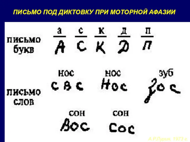 ПИСЬМО ПОД ДИКТОВКУ ПРИ МОТОРНОЙ АФАЗИИ А.Р.Лурия, 1973 г.