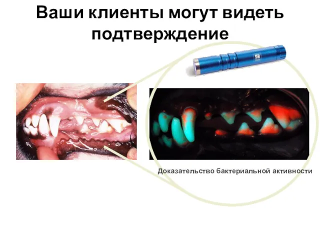 Flashlight Demonstration Доказательство бактериальной активности Based on QLF technology Ваши клиенты могут видеть подтверждение