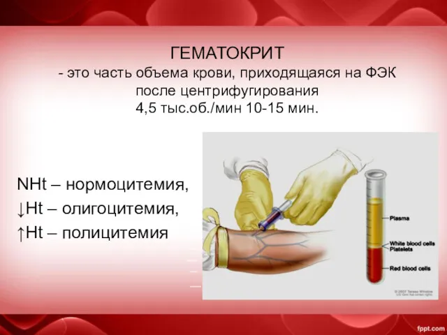 ГЕМАТОКРИТ - это часть объема крови, приходящаяся на ФЭК после центрифугирования 4,5 тыс.об./мин