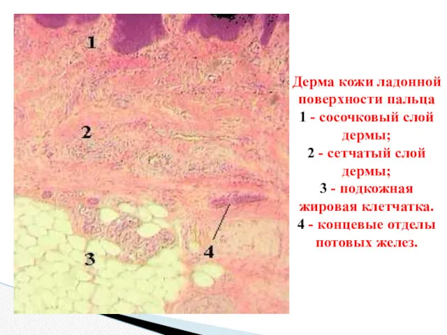 Дерма кожи ладонной поверхности пальца 1 - сосочковый слой дермы;