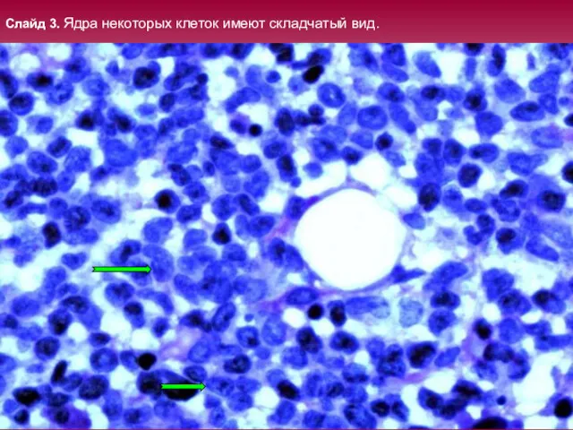 Слайд 3. Ядра некоторых клеток имеют складчатый вид.