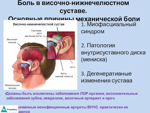 Боль в височно-нижнечелюстном суставе. Основные причины механической боли 1. Миофасциальный