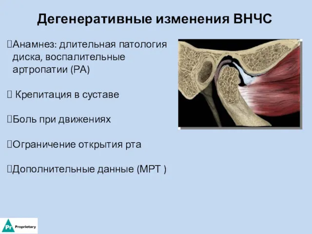 Дегенеративные изменения ВНЧС Анамнез: длительная патология диска, воспалительные артропатии (РА)