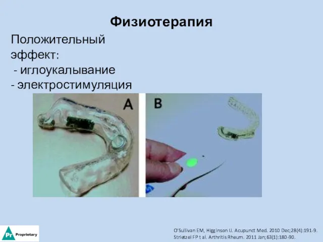 Физиотерапия Положительный эффект: - иглоукалывание - электростимуляция O'Sullivan EM, Higginson