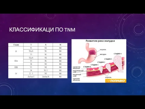 КЛАССИФИКАЦИ ПО TNM