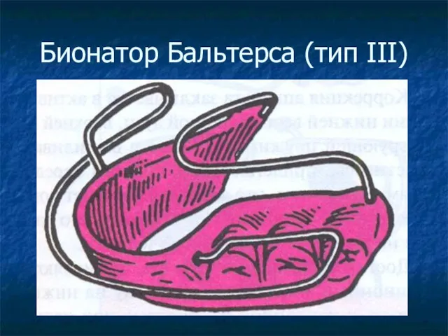 Бионатор Бальтерса (тип III)