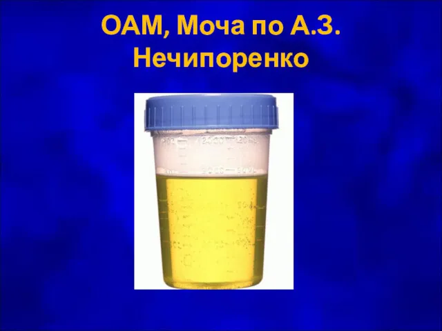 ОАМ, Моча по А.З.Нечипоренко