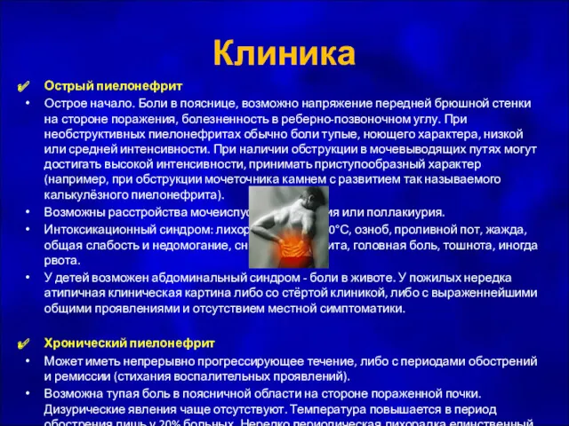 Клиника Острый пиелонефрит Острое начало. Боли в пояснице, возможно напряжение