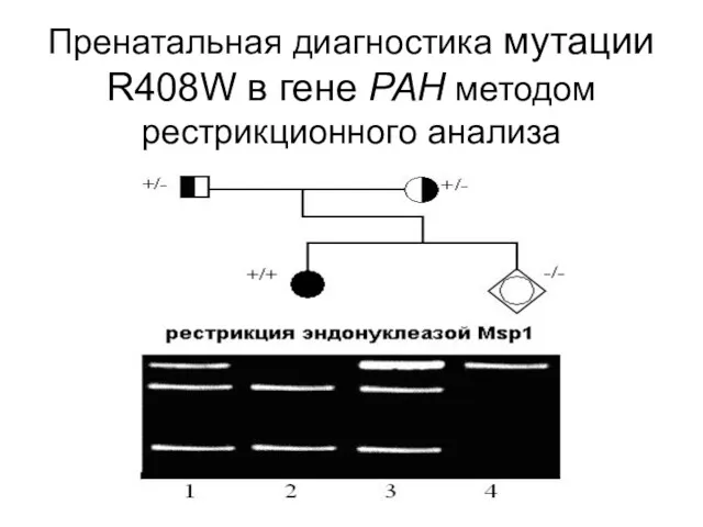 Пренатальная диагностика мутации R408W в гене PAH методом рестрикционного анализа