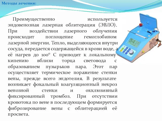 Преимущественно используется эндовенозная лазерная облитерация (ЭВЛО). При воздействии лазерного облучения