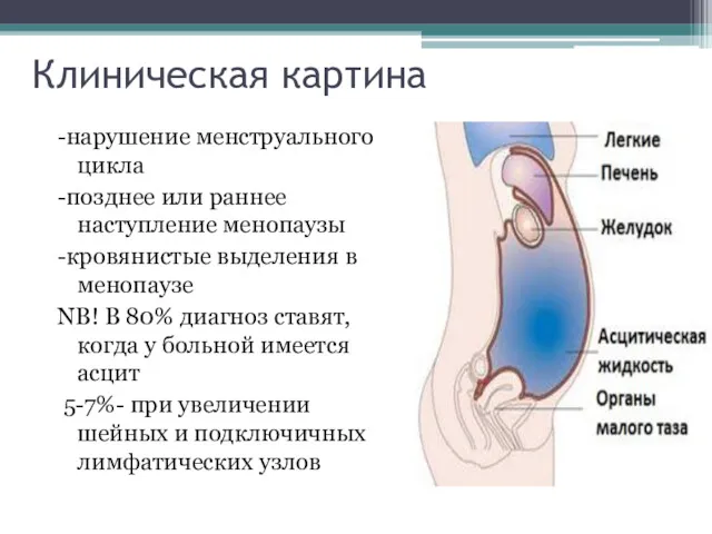 Клиническая картина -нарушение менструального цикла -позднее или раннее наступление менопаузы