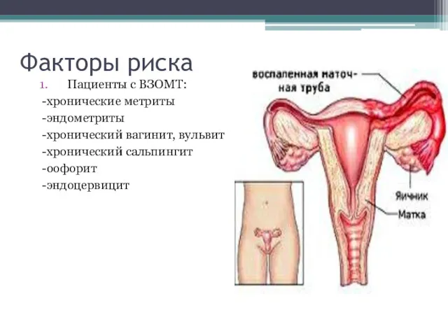 Факторы риска Пациенты с ВЗОМТ: -хронические метриты -эндометриты -хронический вагинит, вульвит -хронический сальпингит -оофорит -эндоцервицит