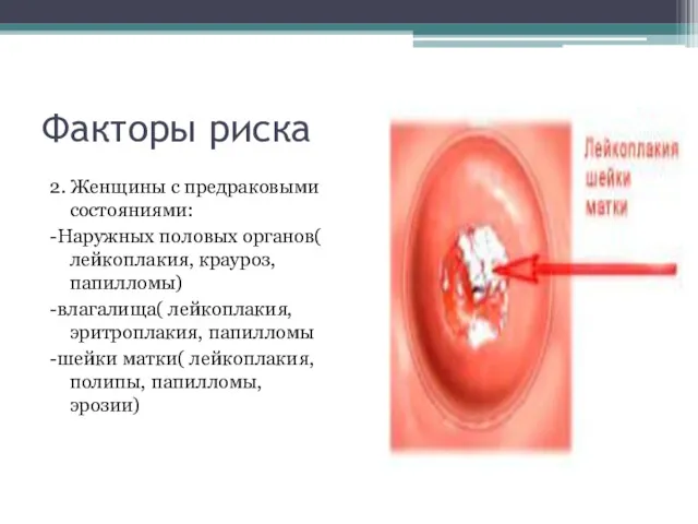 Факторы риска 2. Женщины с предраковыми состояниями: -Наружных половых органов(