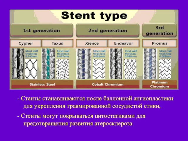 - Стенты станавливаются после баллонной ангиопластики для укрепления травмированной сосудистой