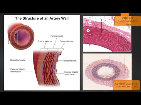 Артерия эластического типа Артерия мышечно-эластического типа