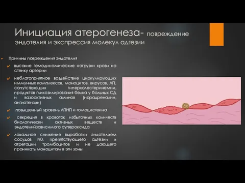 Инициация атерогенеза- повреждение эндотелия и экспрессия молекул адгезии Причины повреждения