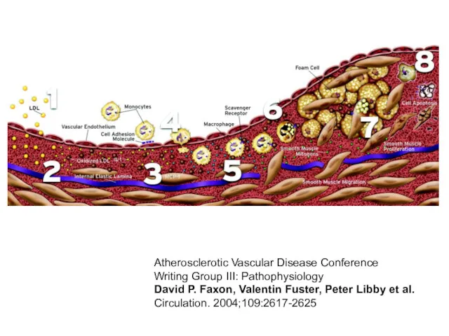 Atherosclerotic Vascular Disease Conference Writing Group III: Pathophysiology David P.