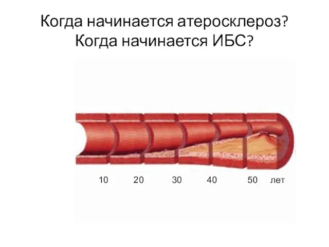 Когда начинается атеросклероз? Когда начинается ИБС? 10 20 30 40 50 лет