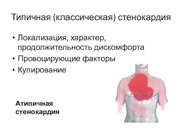 Типичная (классическая) стенокардия Локализация, характер, продолжительность дискомфорта Провоцирующие факторы Купирование Атипичная стенокардия