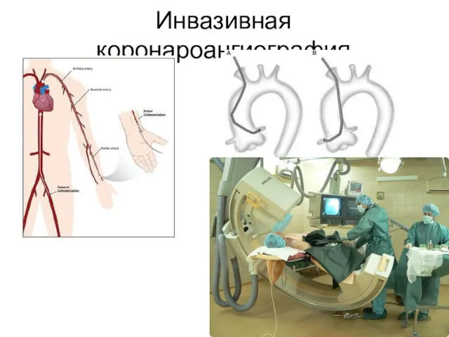 Инвазивная коронароангиография