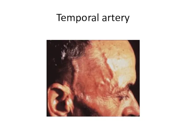 Temporal artery