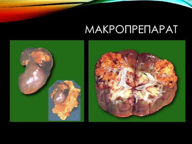 МАКРОПРЕПАРАТ