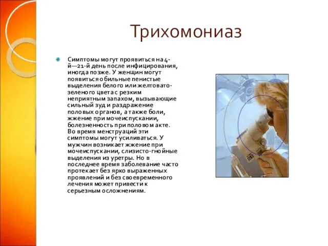 Трихомониаз Симптомы могут проявиться на 4-й—21-й день после инфицирования, иногда