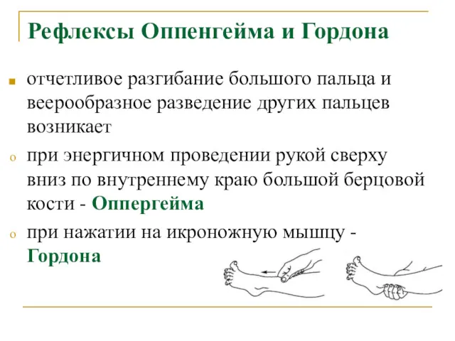 Рефлексы Оппенгейма и Гордона отчетливое разгибание большого пальца и веерообразное