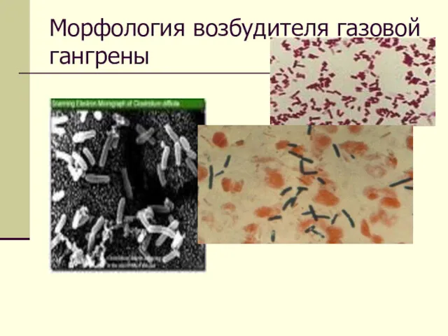 Морфология возбудителя газовой гангрены