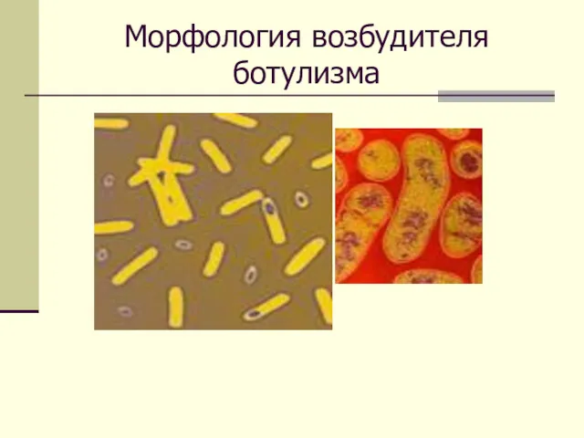 Морфология возбудителя ботулизма