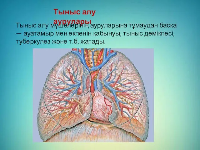 Тыныс алу аурулары Тыныс алу мүшелерінің ауруларына тұмаудан баска —