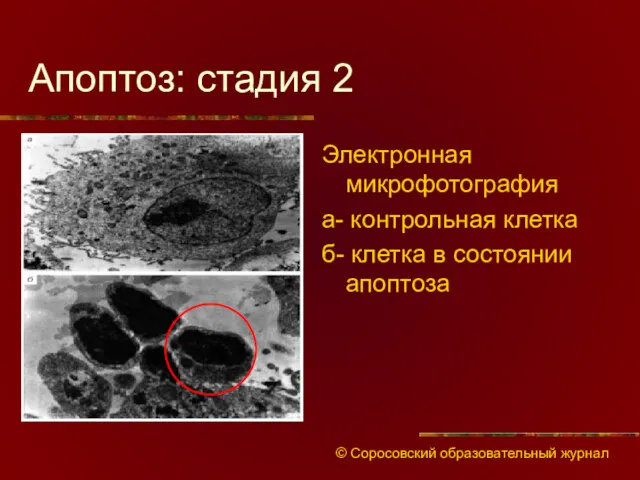 Апоптоз: стадия 2 Электронная микрофотография а- контрольная клетка б- клетка