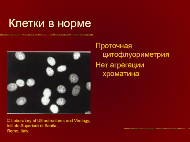 Клетки в норме Проточная цитофлуориметрия Нет агрегации хроматина © Laboratory