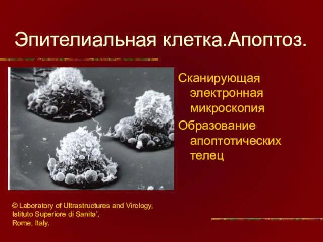 Эпителиальная клетка.Апоптоз. Сканирующая электронная микроскопия Образование апоптотических телец © Laboratory