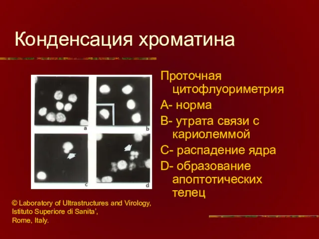 Конденсация хроматина Проточная цитофлуориметрия A- норма B- утрата связи с